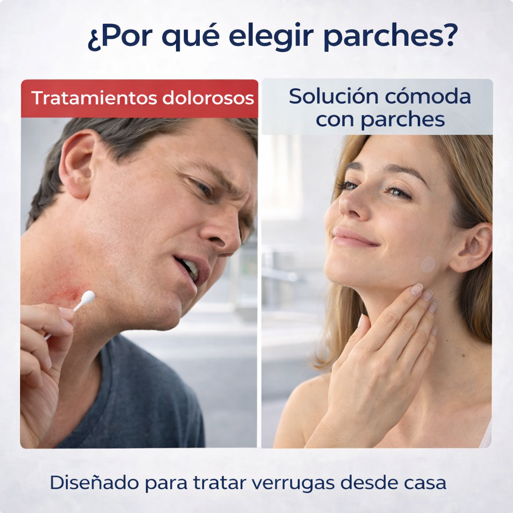 DermClear™ Parches Removedores de Verrugas - 144 unidades